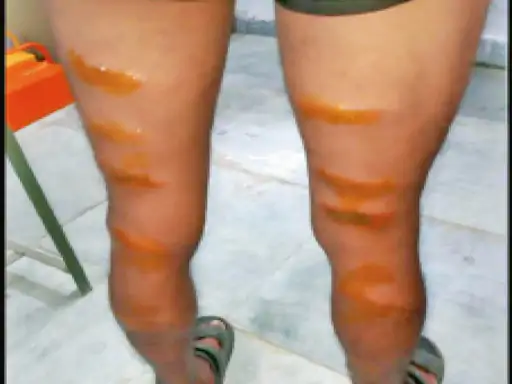 भरतपुर स्कूल में शिक्षक की हैवानियत: जूते नहीं पहनने पर छात्र को बेरहमी से पीटा